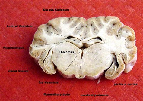 Lateral Ventricle Sheep Brain