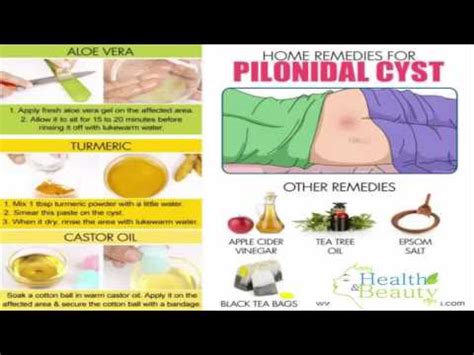 Home Remedies for Pilonidal Cysts - YouTube