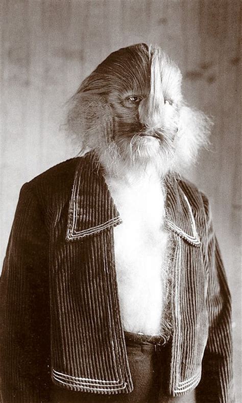 Lionel the Lion-Faced Man | Diane arbus, Human oddities, Vintage circus