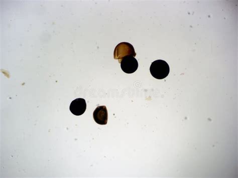 Shrimp Eggs Microscope 40x stock photo. Image of college - 152966396