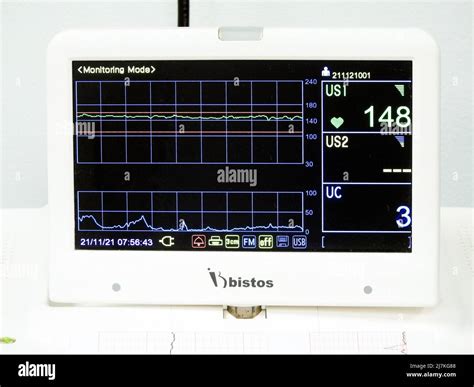 Cairo, Egypt, November 21 2021: Cardiotocography device placed on ...