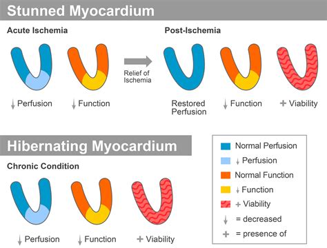 Stunned and Hibernating Myocardium: Where Are We Nearly 4 Decades Later? | Journal of the ...