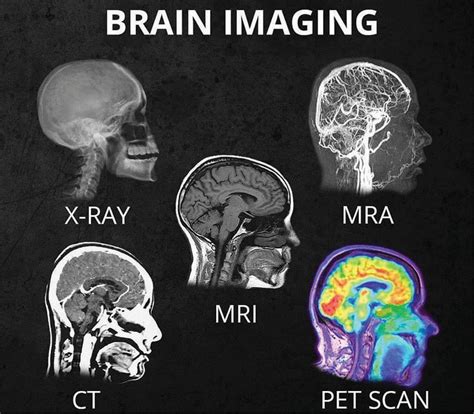 What's the difference between all the different head scans (X-Ray, CT ...