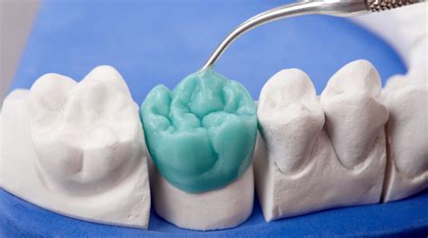 The ultimate guide to dental waxes - Dental Supplies and Equipment ...