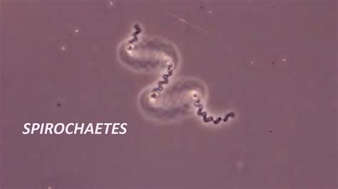 Spirochetes seen through a compound microscope - YouTube