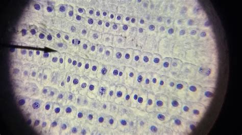 Mitosis Phases Under Microscope - Micropedia