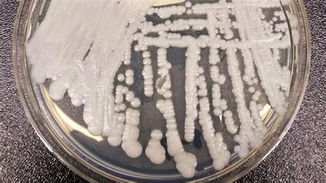 Deadly Candida Auris Fungus Spread Rapidly During Pandemic | Weather.com