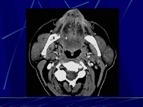 CT ANATOMY OF THE NECK SPACES