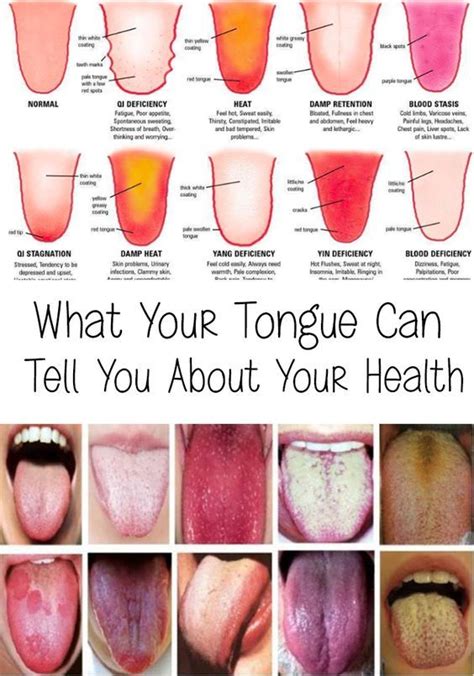 What Your Tongue Can Tell You About Your Health | Tongue health, Healthy tongue, Health tips