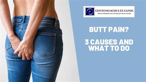 The Top 3 Causes for Butt Pain - Regenexx Blog