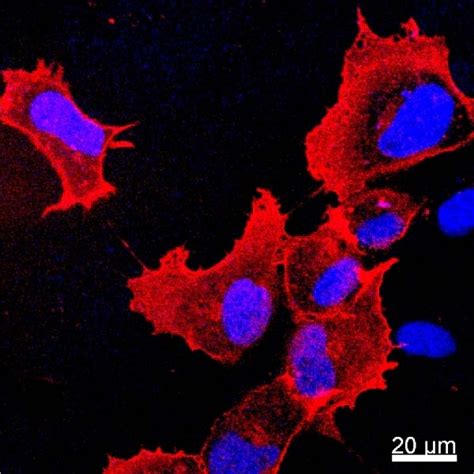 Antifade Solution For Immunofluorescence Microscopy (Part AF-1, anti fade, anti-fade)