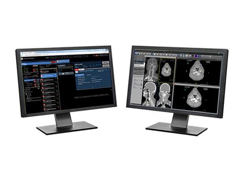 NVIDIA extends AI healthcare partnership with GE - Converge Digest