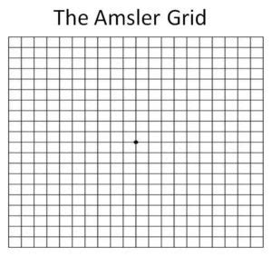 The Amsler Grid For Macular Degeneration - Millennium Eye Center