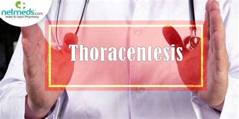 Thoracentesis Procedure Steps