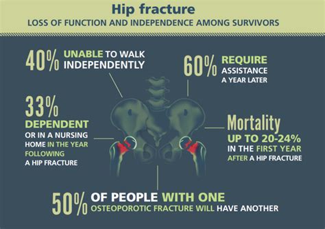 Osteoporosis Is More Than Just a Number - American Bone Health