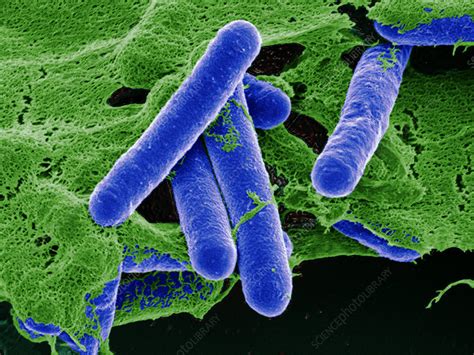 Clostridium botulinum bacteria - Stock Image - B220/1273 - Science Photo Library