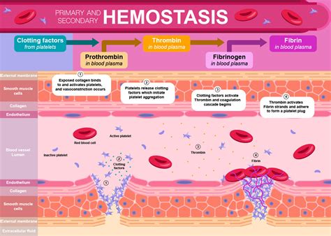 Stages Of Hemostasis