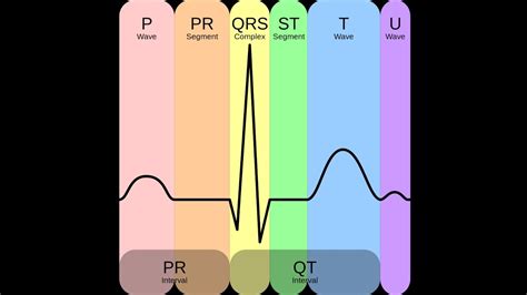 Non ST Elevation Myocardial Infarction (NSTEMI) in an Old Patient - YouTube