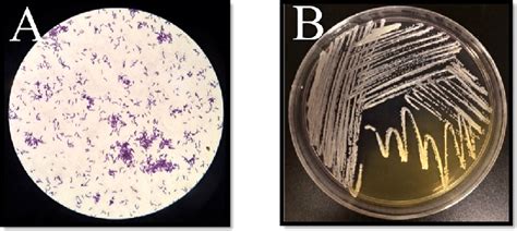 Acne Microscope