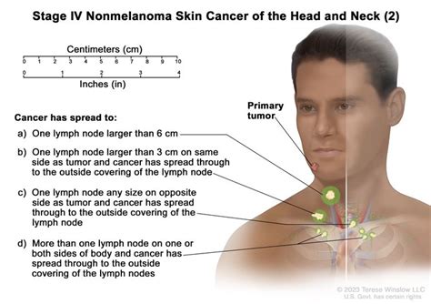 Skin Cancer Treatment - NCI