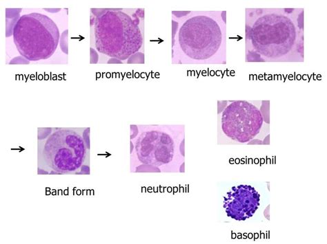 Image result for myelocyte | Hematology, Medical laboratory scientist, Medical laboratory science