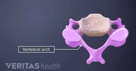 Neural Arch Definition | Back Pain and Neck Pain Medical Glossary