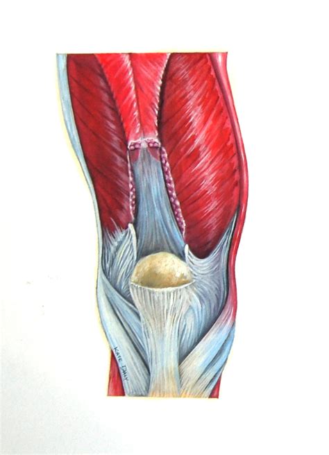 Kate Daly Medical Illustration: Illustration of Quadriceps Tendon Repair