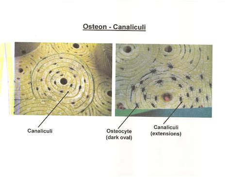 ANATOMY & PHYSIOLOGY I BIS 240: Osteon-Canaliculi