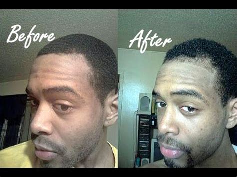 Three 100% Natural Hair Regrowth Success Stories & Before & After Time ...