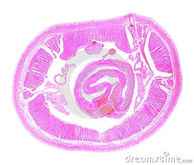 Earthworm Under The Microscope Stock Photos - Image: 27282353