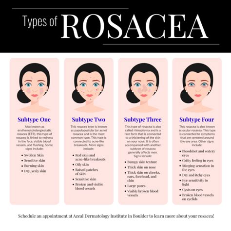 How To Treat Rosacea Causes Symptoms Types Skinkraft - vrogue.co