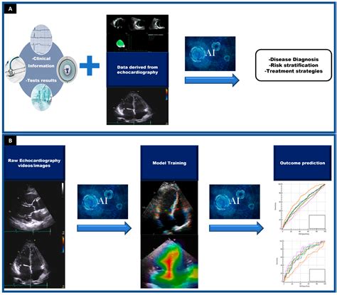 J. Imaging | Free Full-Text | The Role of Artificial Intelligence in Echocardiography