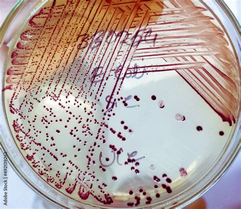 Bacteria colony of Escherichia coli (E.coli) in culture media plate. foto de Stock | Adobe Stock