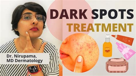 Dark Spots Treatment| How to get rid of Dark Spots| Pigmentation treatment | Dr Nirupama - YouTube