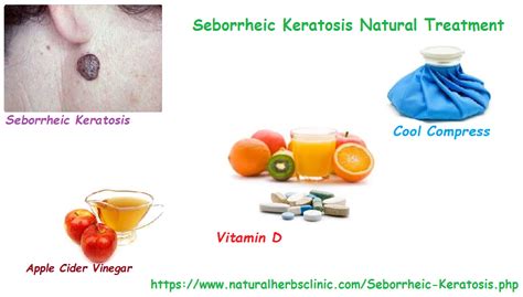 Seborrheic Keratosis Natural Treatment - Natural Herbs Clinic