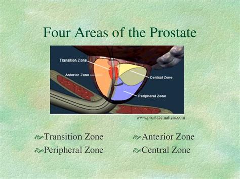 PPT - Possible Loci Linked to Prostate Cancer PowerPoint Presentation, free download - ID:230819