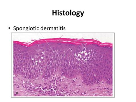 PPT - Skin Pathology PowerPoint Presentation, free download - ID:1942011