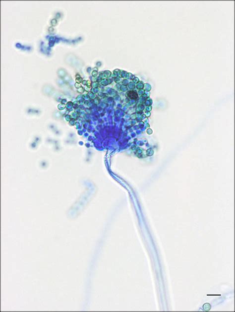 Aspergillus Flavus Under Microscope