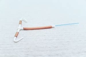 When Will Get Period After IUD Removal? - Raleigh Gynecology & Wellness