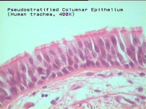 pseudostratified ciliated columnar | Histology slides, Trachea, Slides