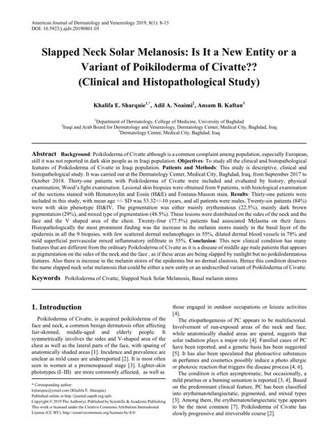 Poikiloderma of Civatte, Slapped Neck Solar Melanosis, Basal Melanin ...