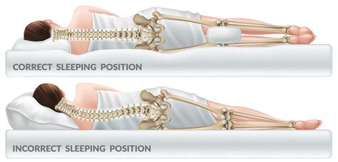 Sleeping With Sciatica Pain - How To Cure Sciatica