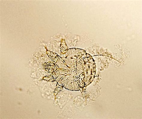 Scabies Microscope