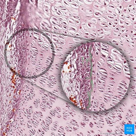 Fibrocartilage Histology