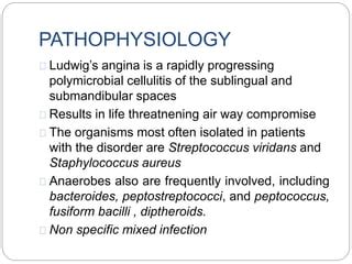 Ludwigs angina | PPT