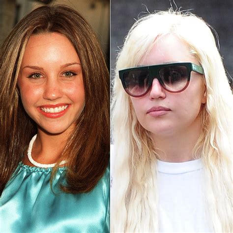 Amanda Bynes Transformation: See How Much She's Changed!