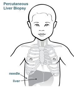 Percutaneous Liver Biopsy - Stanford Medicine Children's Health