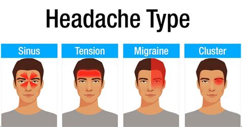 10 Different Types Of Headaches And What Causes Them | Headache types ...