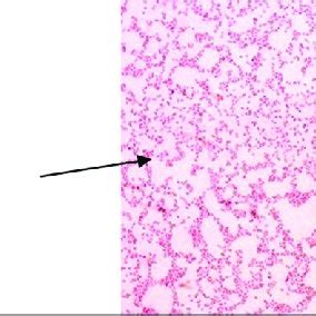 Gram-staining of Salmonella isolates. | Download Scientific Diagram