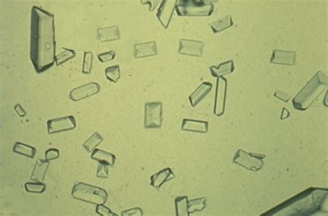 Urinalysis